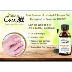 Nail Fungus Treatment Solution with 25% undecylenic acid